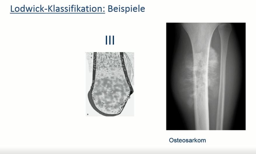 #2210: Für die Praxis - Diagnostik von Knochentumoren – thumbnail 2 of 5