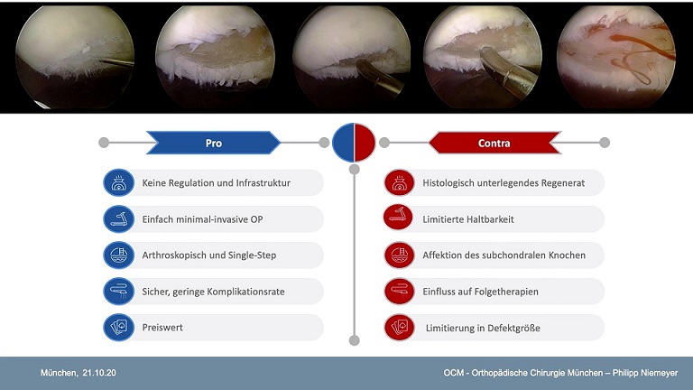 #2110: Scientific Battle - 3 Techniques in Minimally Invasive Cartilage Repair – thumbnail 2 of 7