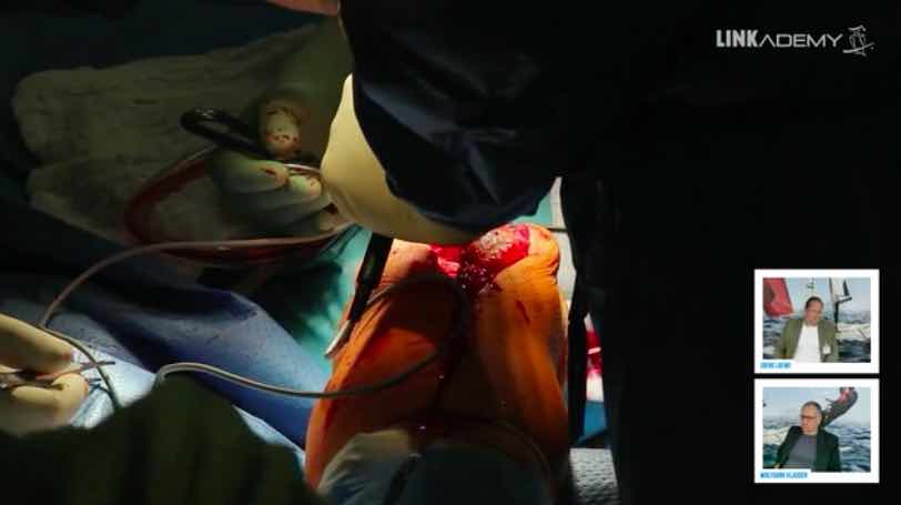 #214: Through the Eyes of the Surgeon - Challenging and Live Knee Revision – thumbnail 2 of 5