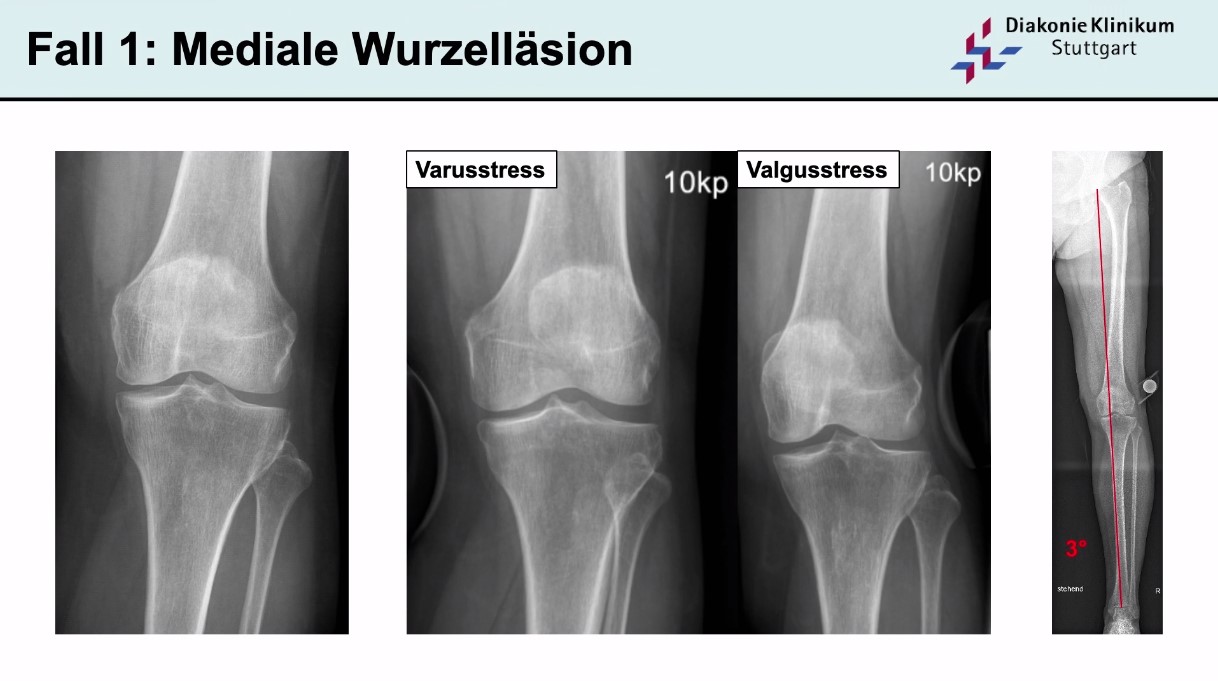 AGAnywhere Monthly - #027: Evidenzbasierte Behandlung von degenerativen Gelenkschäden – thumbnail 2 of 12