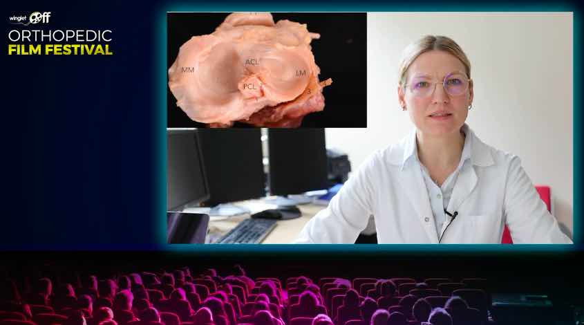 Orthopedic Film Festival 2022 - Lower Extremity – thumbnail 2 of 17