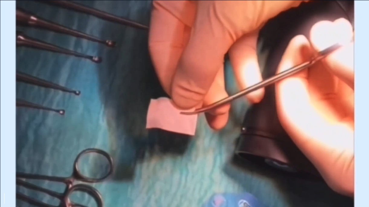 Orthopedic Film Festival 2024 – Lower Extremity & Sports – thumbnail 2 of 16