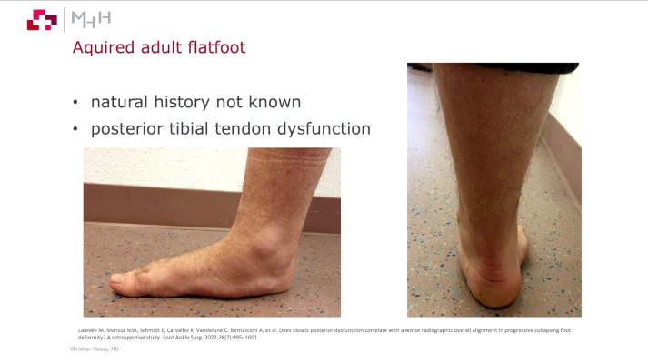 Winglet Originals #026: Flatfoot - From Youth to Elderly – thumbnail 2 of 12