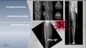 AGAnywhere Monthly - #020: UpDate VKB-Revision: Management und operative Strategien – thumbnail 2 of 12