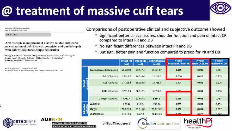 Winglet Originals #009: Massive Tears of the Rotator Cuff – thumbnail 2 of 12