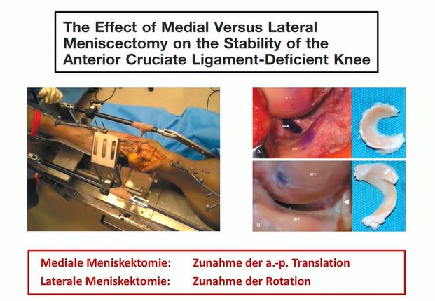 #1610: Update Meniskuschirurgie – thumbnail 2 of 8