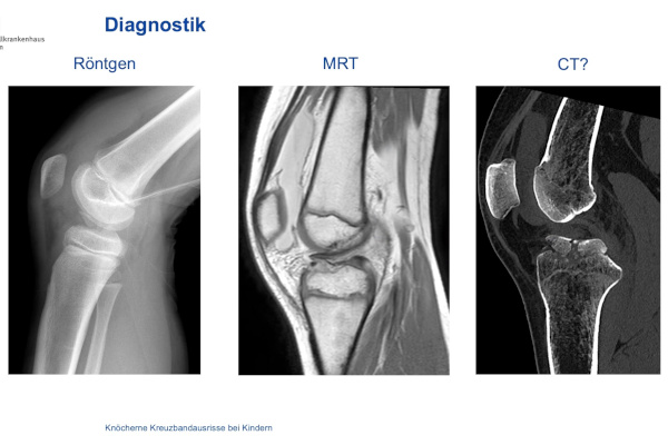 AGAnywhere Monthly - #034: Osteoligamentäre Verletzungen des kindlichen Knies und Ellenbogens – thumbnail 2 of 10
