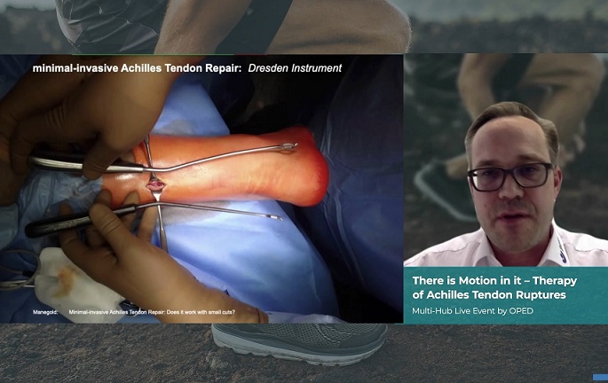 #809: There is Motion in it - Therapy of Achilles Tendon Ruptures – thumbnail 2 of 6