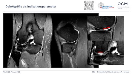 #202: Patienten mit Knorpeldefekten im Kniegelenk  – thumbnail 2 of 7