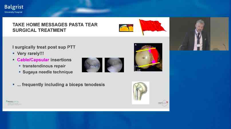 Balgrist International Shoulder Course - Rotator Cuff Disorders – thumbnail 2 of 10