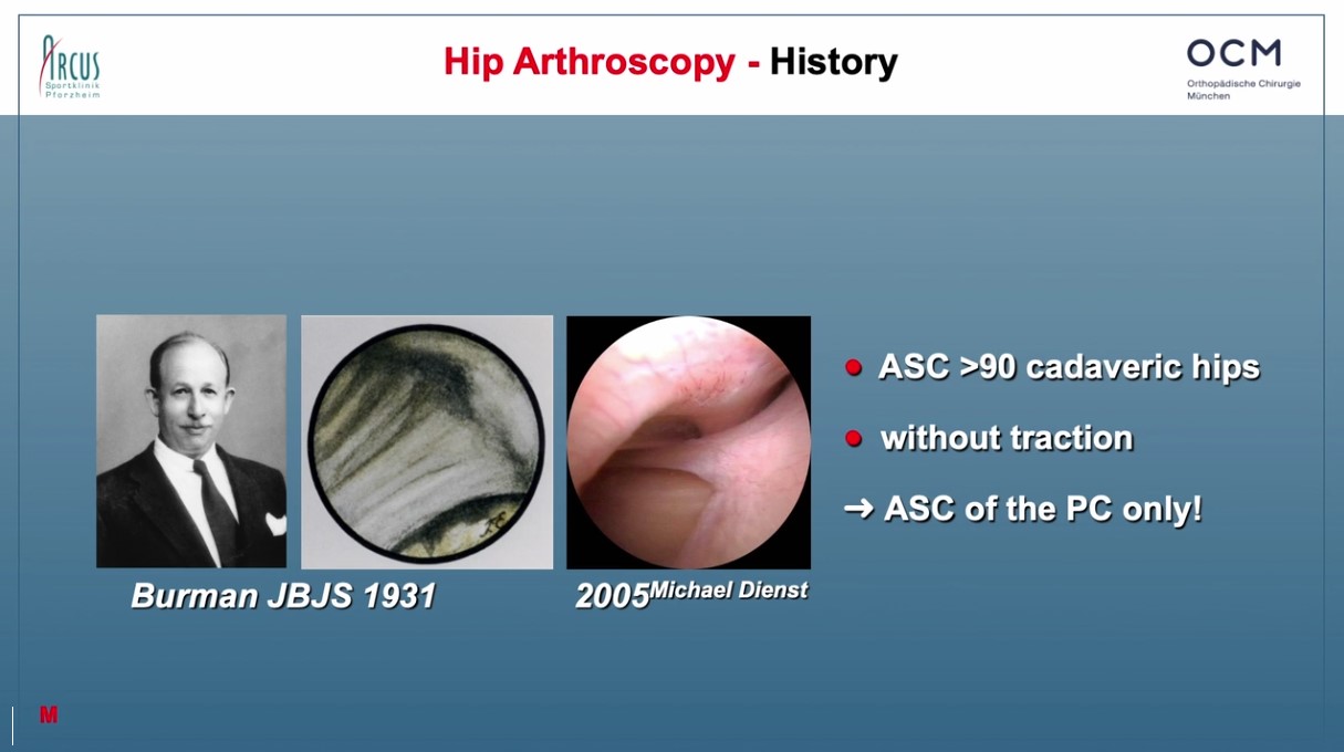 Winglet Originals #024: Hip Preserving Surgery - From A-Arthroscopy to P-PAO – thumbnail 2 of 12