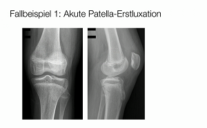 #1010: Insights from the OR - Patellainstabilität – thumbnail 2 of 9
