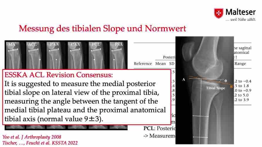 AGAnywhere Monthly - #017: Osteotomie advanced - Was geht alles? – thumbnail 2 of 11