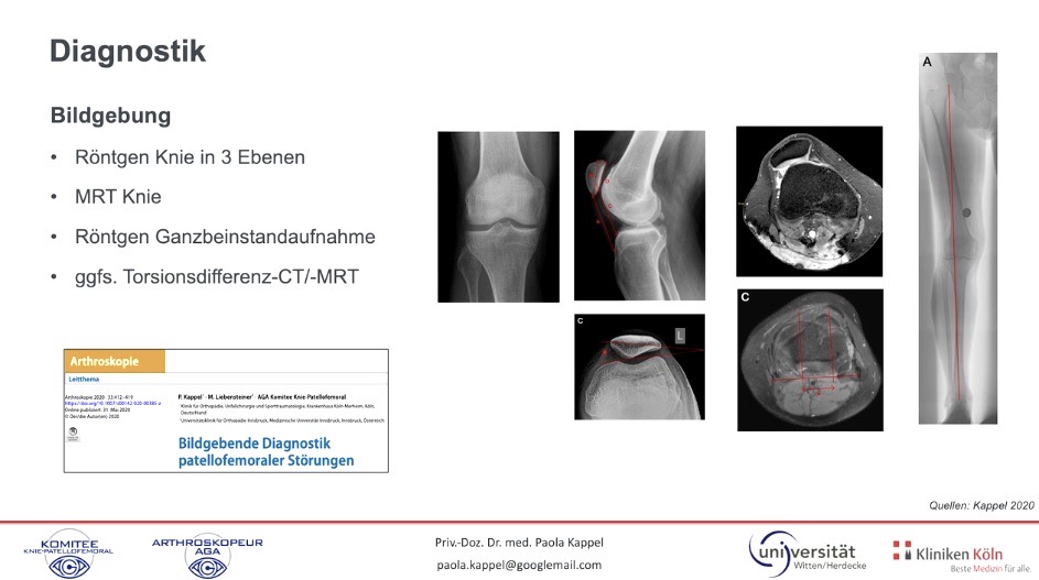 AGAnywhere Monthly - #008: Patellofemorale Instabilität – thumbnail 2 of 12