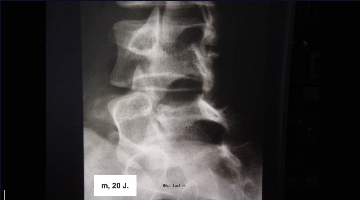 #2911: Der Kreuzschmerz in der Hausarzt- und Orthopädie-Praxis – thumbnail 2 of 11