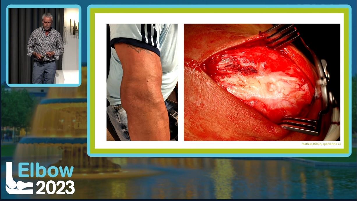 Elbow 2023 – thumbnail 3 of 38
