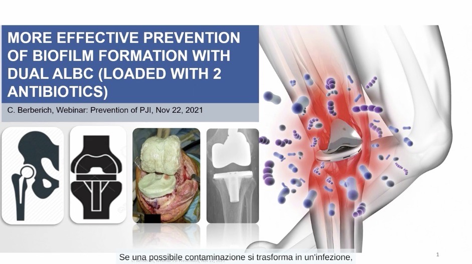 #2211: Prevention of Periprosthetic Joint Infection with Bone Cement in Italy – thumbnail 3 of 9