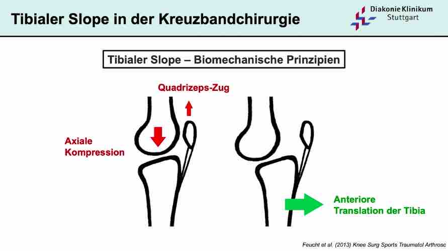 AGAnywhere Monthly - #017: Osteotomie advanced - Was geht alles? – thumbnail 3 of 11