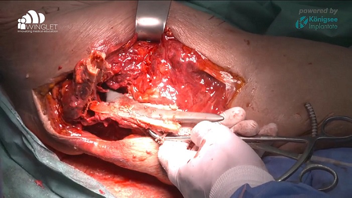 DKOU 2019 Wetlab - BioSkills Workshops & Live-Demonstrationen – thumbnail 3 of 10