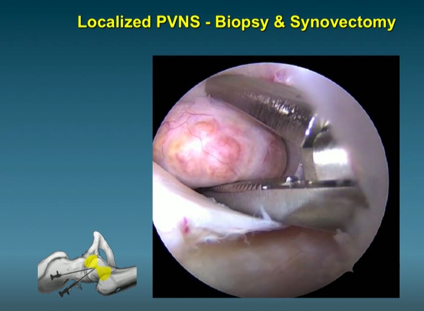 #192: Hip International - Basic Principles of Hip Arthroscopy – thumbnail 3 of 13