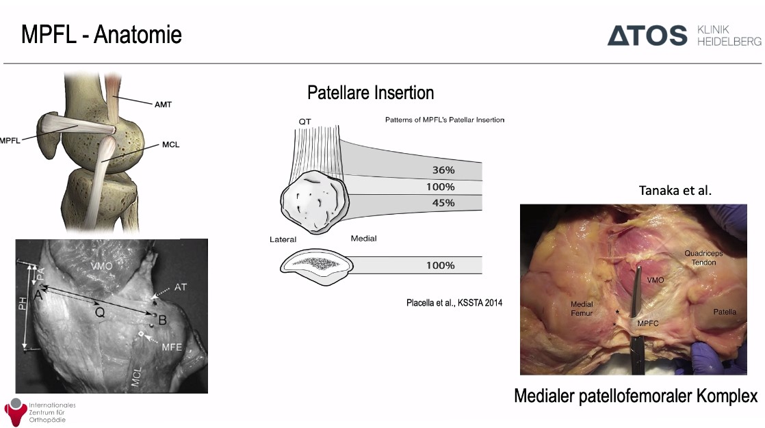 AGAnywhere Monthly - #022: Die patellofemorale Instabilität – thumbnail 3 of 12