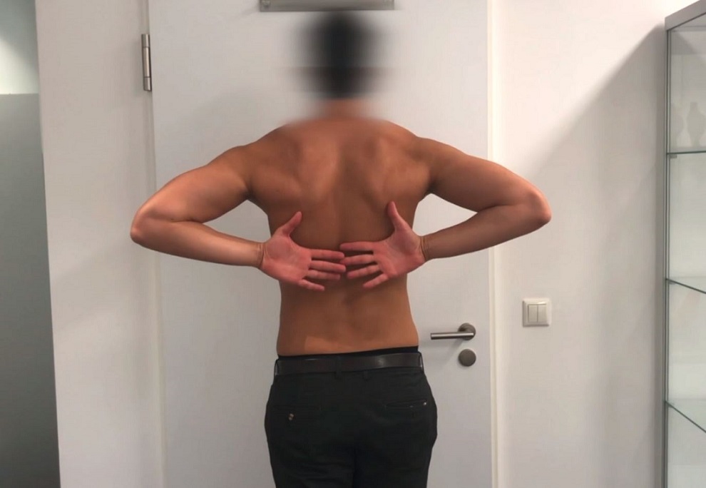 #2611: Update Rotatorenmanschette – thumbnail 3 of 12