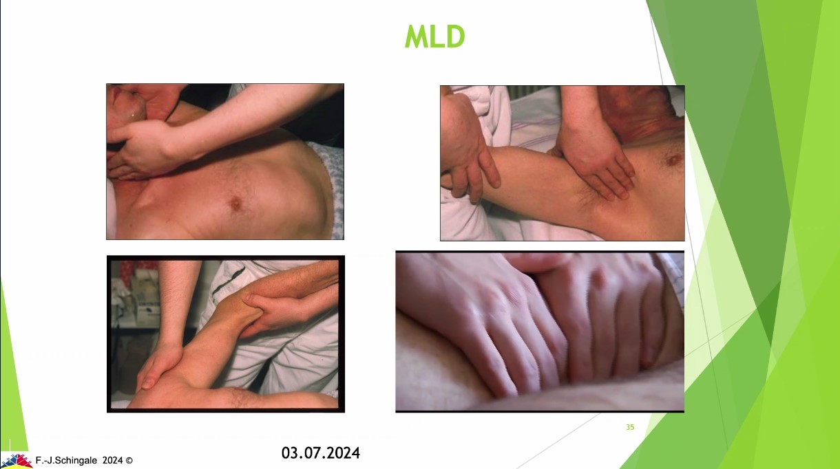#307: Faszination Lymphologie: Lymphödem & Lipödem – thumbnail 3 of 12