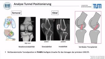 AGAnywhere Monthly - #020: UpDate VKB-Revision: Management und operative Strategien – thumbnail 3 of 12