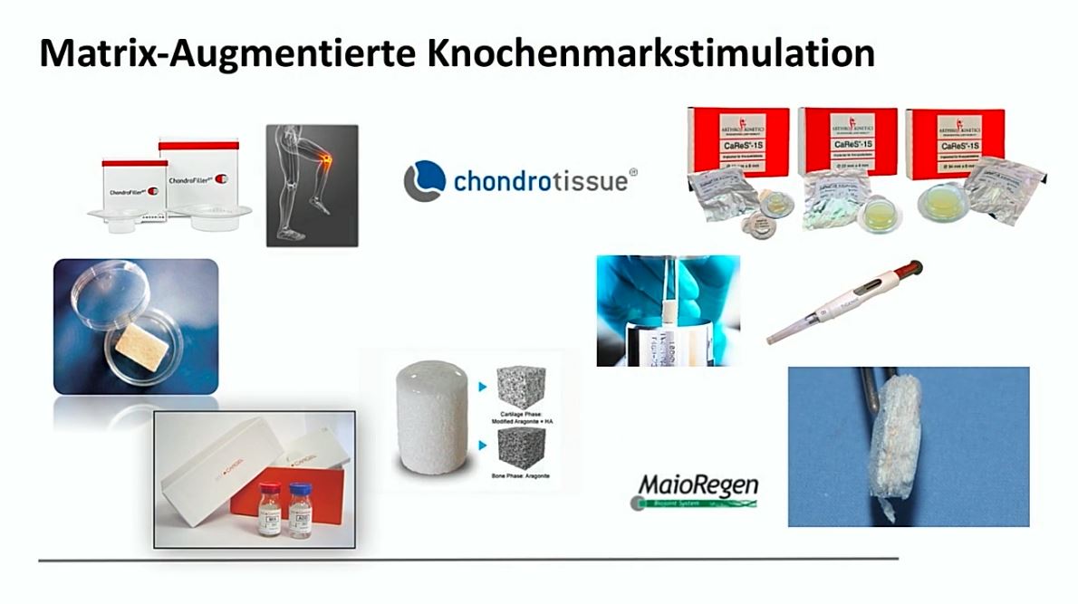 #191: Insights from the OR - Knorpelchirurgie II – thumbnail 3 of 10
