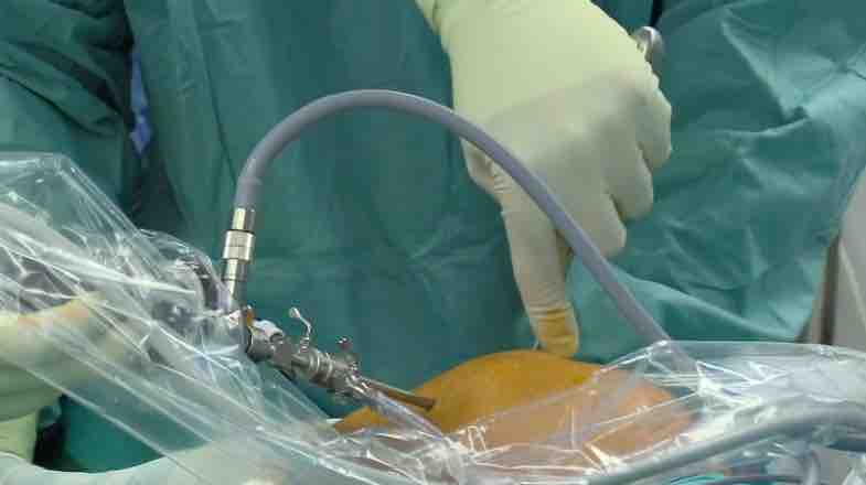 #704: Knorpelzelltransplantation mit Novocart® in der täglichen Praxis – thumbnail 3 of 10