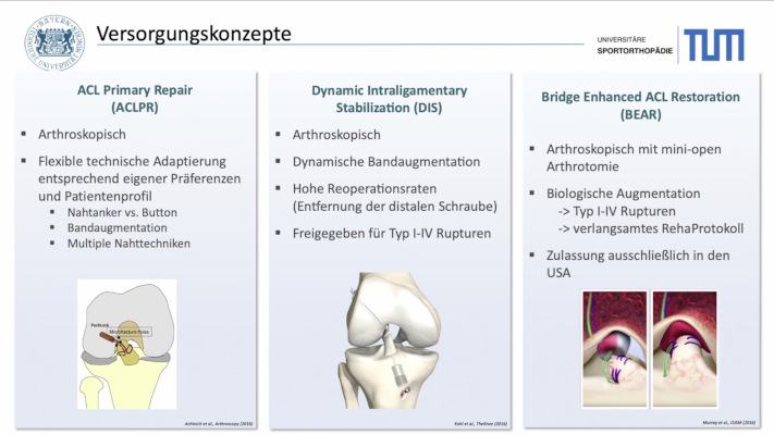 AGAnywhere Monthly - #036: Kindliche Kreuzbandverletzungen – thumbnail 3 of 10