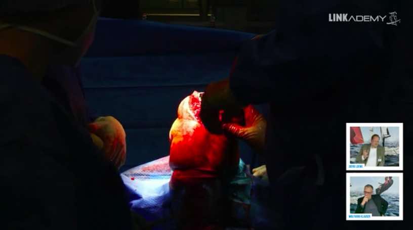 #214: Through the Eyes of the Surgeon - Challenging and Live Knee Revision – thumbnail 3 of 5