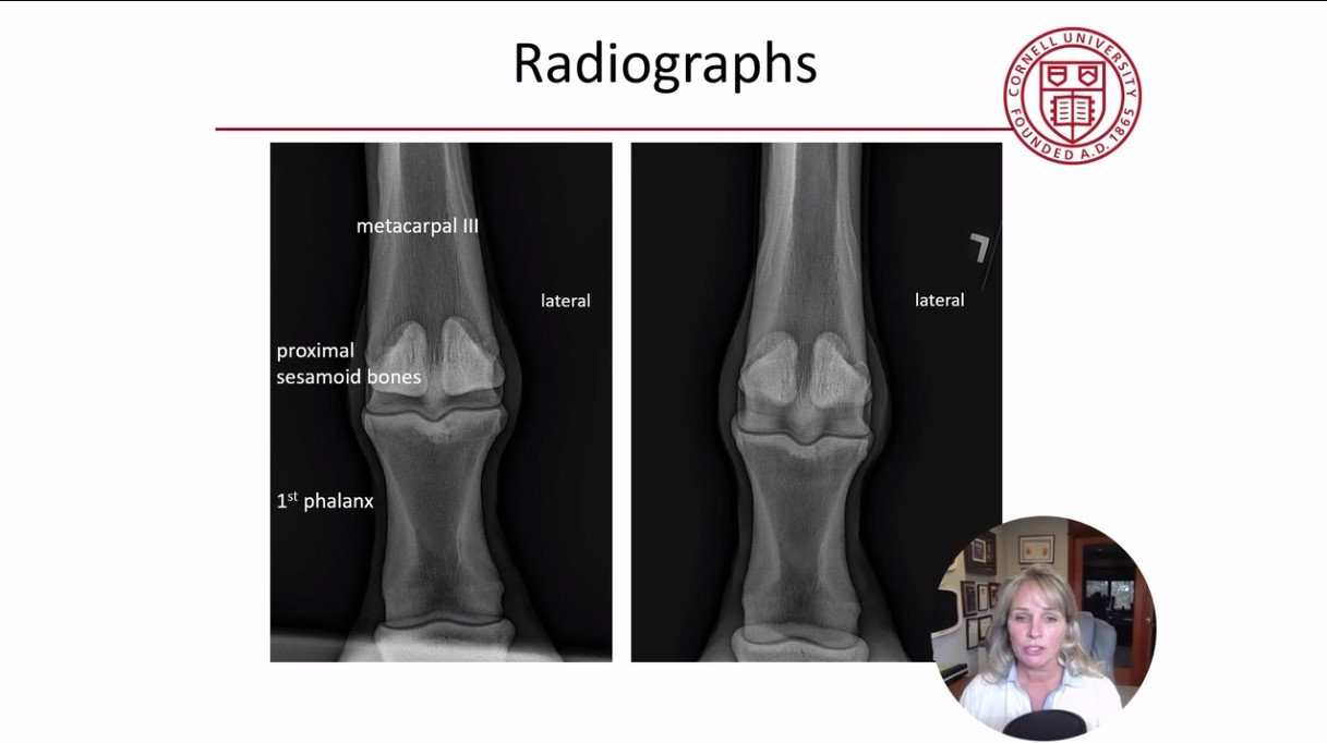 ICRS TV Series - #005: Biologic Knee Replacement: Basic Science of Aging of Cartilage – thumbnail 4 of 12