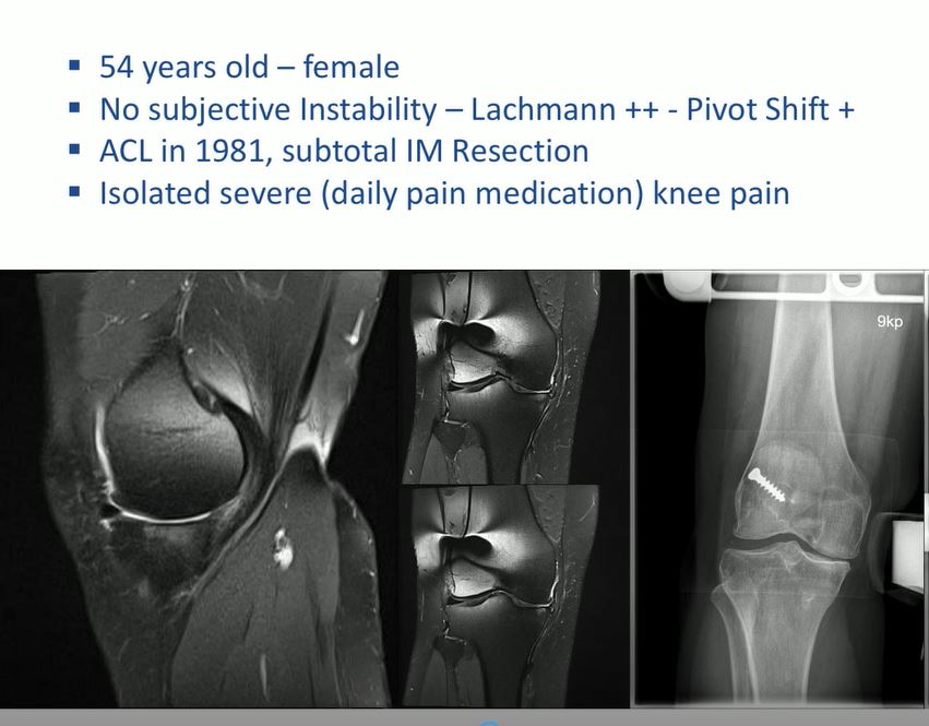 #164: Knee International II – thumbnail 4 of 10