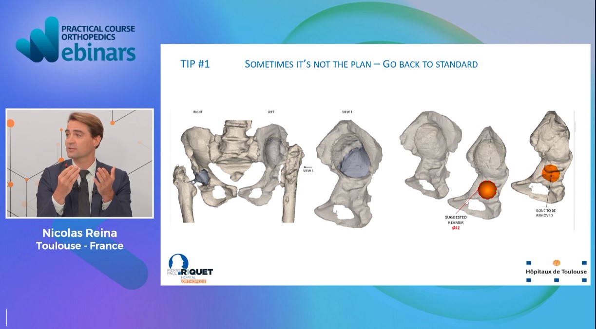 #106: Complex Reconstruction Cases – thumbnail 4 of 7