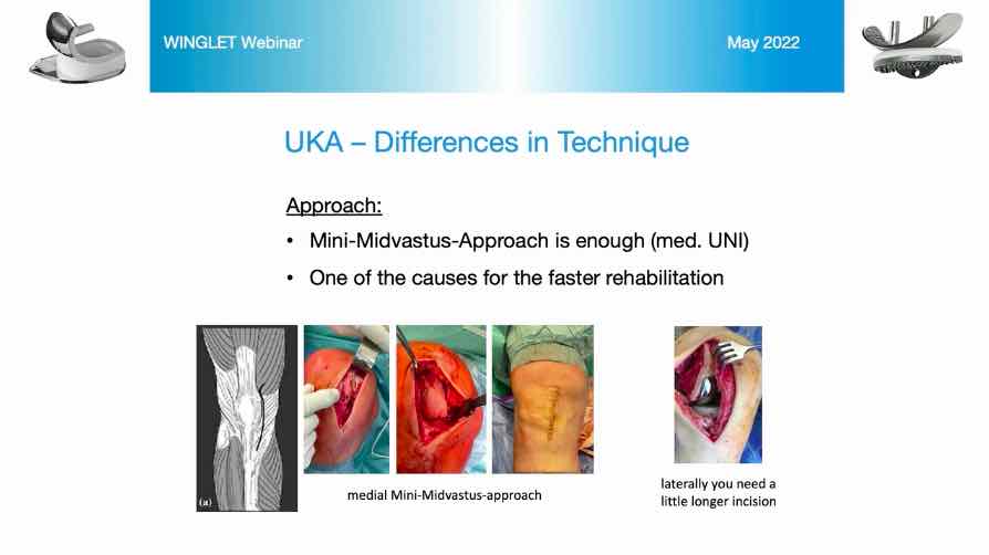 #105: Unicondylar vs. Total Knee - When and How to Use What – thumbnail 4 of 9