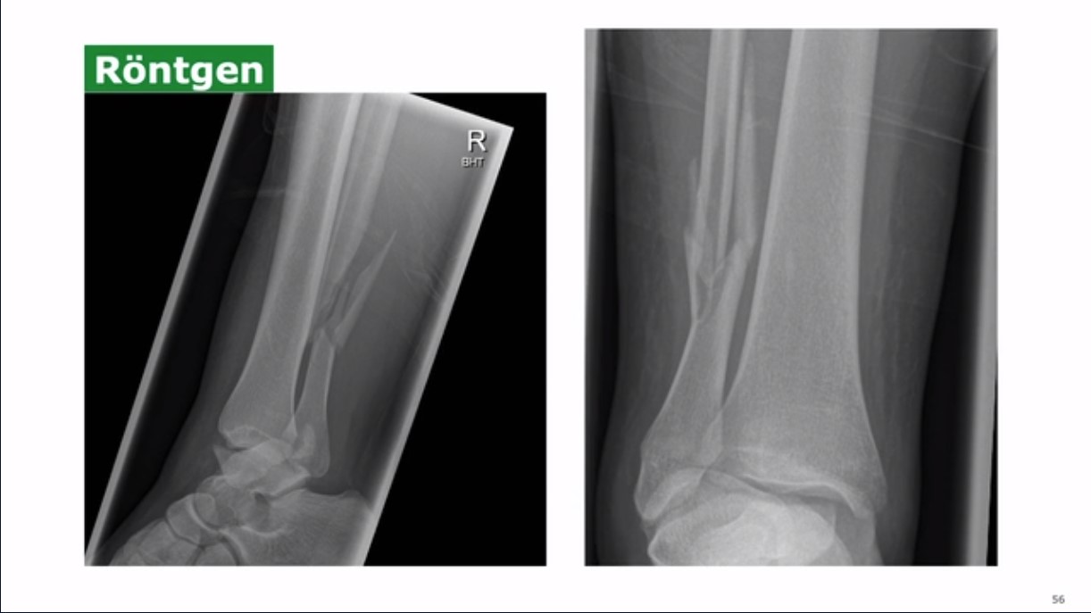 VSOU TV-Serie: Folge 1 - Oberes Sprunggelenk & Work-Life-Balance in O und U – thumbnail 4 of 11