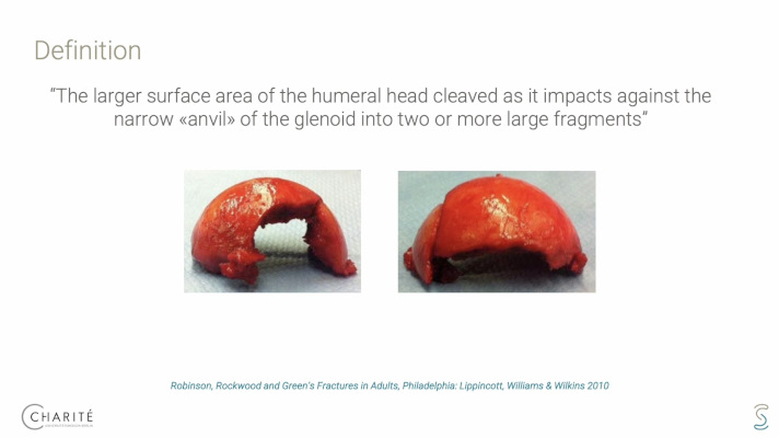 Winglet Originals #028: Complex Humerus Fractures – thumbnail 4 of 11