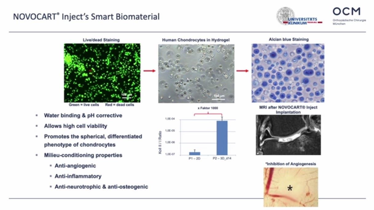 ICRS TV Series - #008: Chondrocyte and Fragmented Cartilage: Products and Procedures – thumbnail 4 of 12