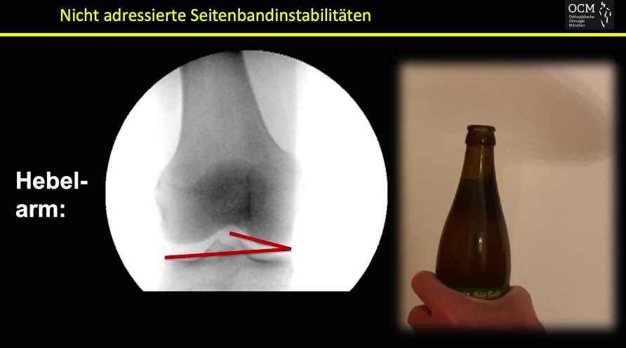 Spezifischer Knieschmerz - Session 1: Instabilitäten – thumbnail 4 of 10