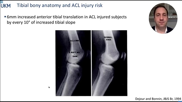 #173: Anatomy and Biomechanics of the Knee – thumbnail 4 of 8