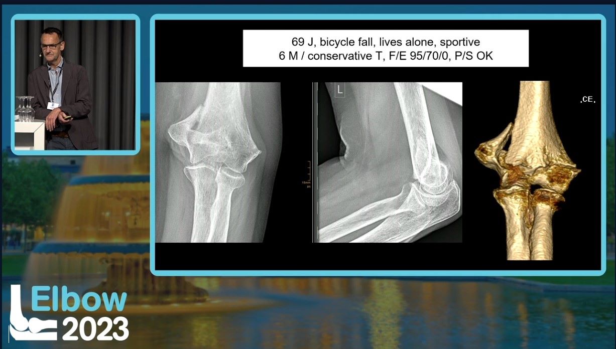 Elbow 2023 – thumbnail 22 of 38