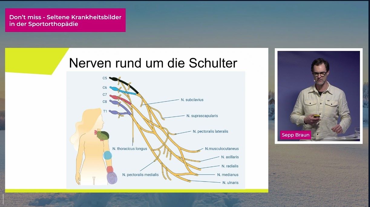 #261: Don’t miss - Seltene Krankheitsbilder in der Sportorthopädie – thumbnail 4 of 15