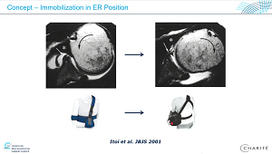 #711: Shoulder International – thumbnail 4 of 12