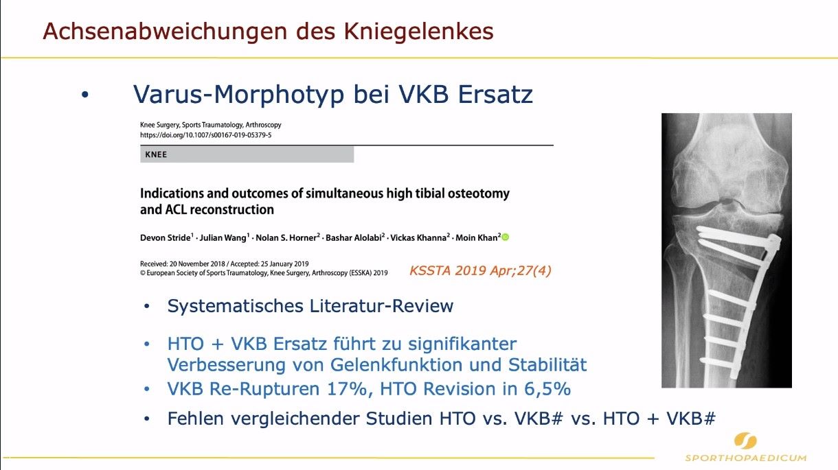 AGAnywhere Road2Berlin – Episode 2: Ossäre Deformitäten bei Kreuzbandverletzung – thumbnail 4 of 11