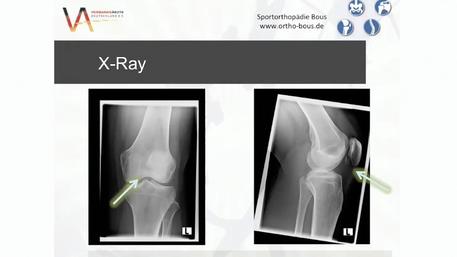 #911: Individualized Treatment of Osteoarthritis of the Knee – thumbnail 7 of 10