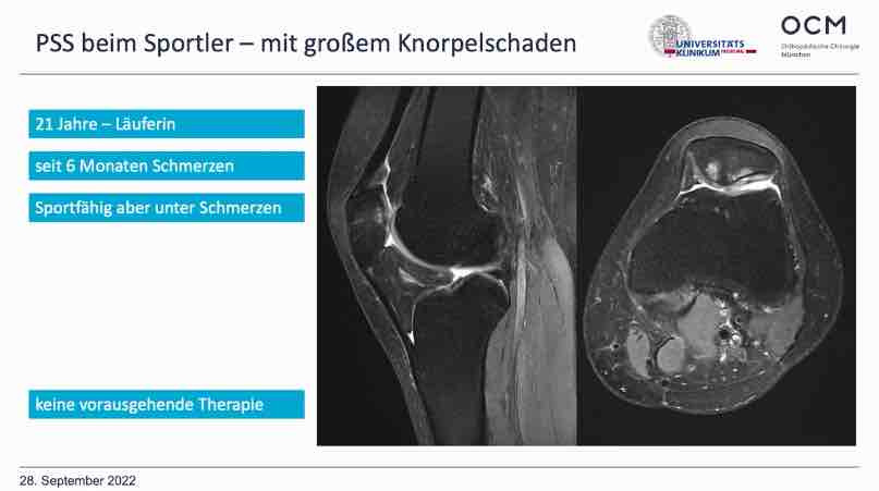 Spezifischer Knieschmerz - Session 2: Patella – thumbnail 5 of 10