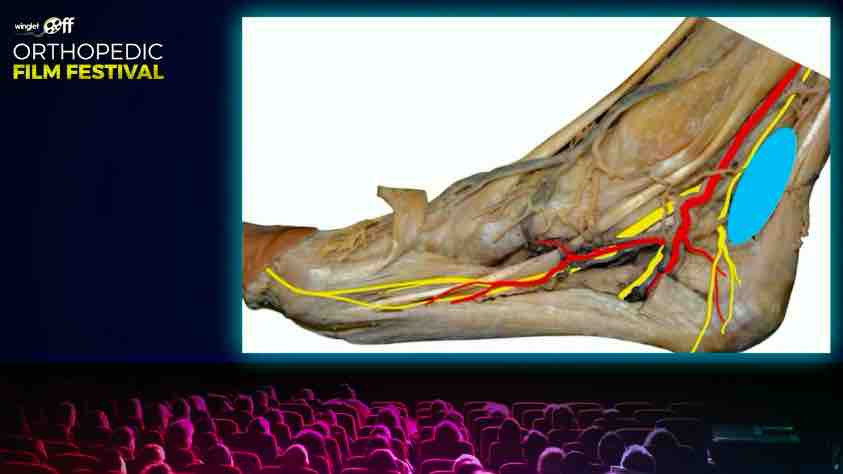 Orthopedic Film Festival 2022 - Lower Extremity – thumbnail 5 of 17