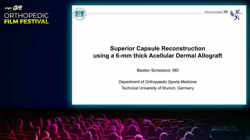 Orthopedic Film Festival 2022 - Upper Extremity – thumbnail 5 of 19
