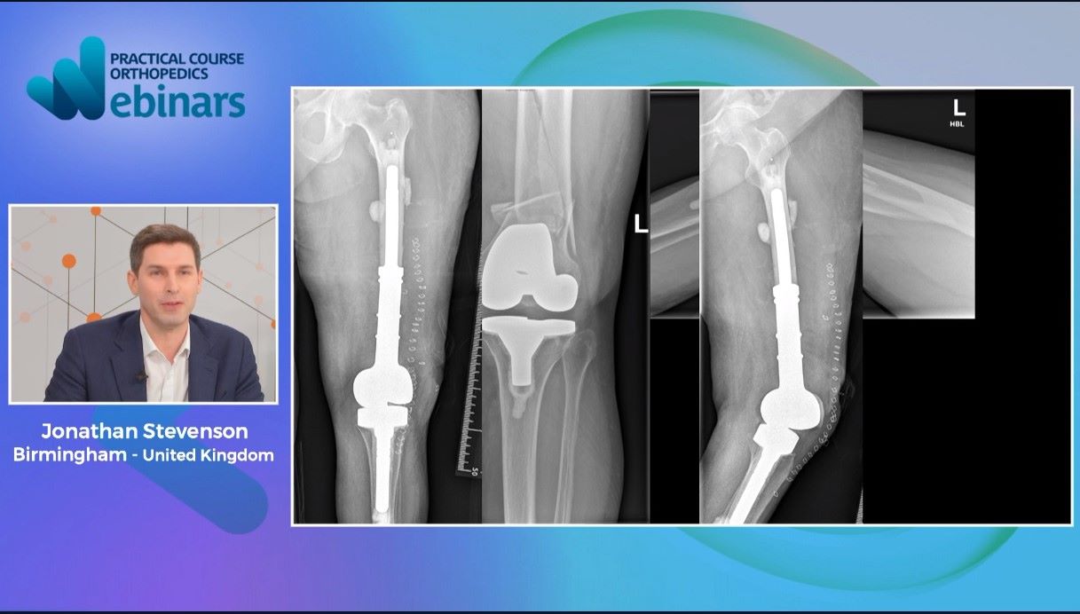 #106: Complex Reconstruction Cases – thumbnail 5 of 7